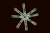 Asterionella formosa algae, light micrograph