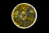 Coscinodiscus alga, light micrograph