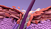 Blocked pore, illustration