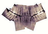 Röntgenbilder von reifen Zähnen