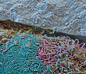 Bacteria in tooth cavity, SEM