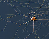 Spinal ganglion nerve cell, SEM