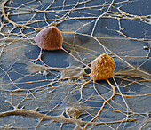 Spinal ganglion nerve cells, SEM