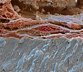 Keratinised gingiva, SEM