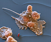 Macrophages, SEM