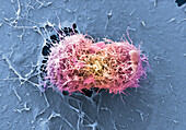 Cervical cancer cells dividing, SEM