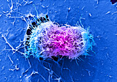 Cervical cancer cells dividing, SEM