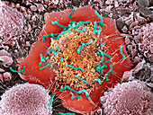 Macrophages infected with Streptococcus pyogenes, SEM