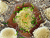 Macrophages infected with Streptococcus pyogenes, SEM