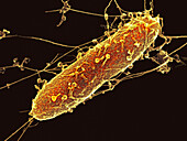 Bacteriophages attacking Pseudomonas aeruginosa bacterium, SEM