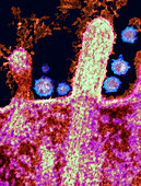 Cell infected by SARS-CoV-2 virus particles, TEM
