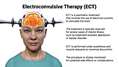 Electroconvulsive therapy, illustration