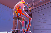 Musculoskeletal disorders in lab workers, illustration