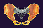 Anatomy of the coxal bones, illustration