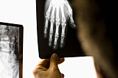 Hand einer medizinischen Fachkraft hält Röntgenbild einer Hand