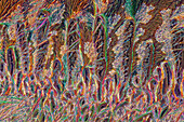 Das Bild zeigt kristallisierten Kallusentferner, fotografiert durch das Mikroskop in polarisiertem Licht bei einer Vergrößerung von 100X