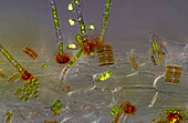 Das Bild zeigt verschiedene winzige Algen, die sich auf der Wurzel von Lemna sp. angesiedelt haben, fotografiert durch das Mikroskop in polarisiertem Licht bei einer Vergrößerung von 200X