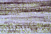 The image presents tissues in nettle stalk in longitudinal cross-section, photographed through the microscope in polarized light at a magnification of 100X\n