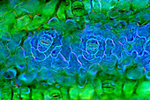 The image presents stomata in Spathiphyllum leaf epidermis, photographed through the microscope in polarized light at a magnification of 100X\n