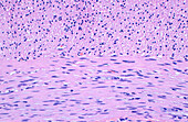 Appendix intestinal smooth muscle layers, light micrograph