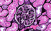 Glomerulus, light micrograph