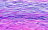 Keratin from skin cyst, light micrograph