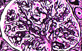 Membranous glomerular disease, light micrograph