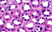 Kidney tubules, light micrograph