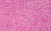 Smooth muscle in seminal vesicle, light micrograph