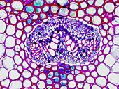 Fern leaf, light micrograph