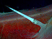 Stinging nettle hairs, light micrograph