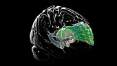 Anterior thalamic radiation, DTI MRI scan