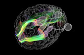 Brain's visual pathways, DTI MRI scan