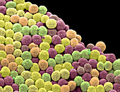 Keyboard bacteria, SEM