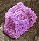 Prostate epithelial cell, SEM