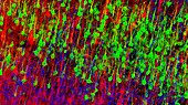 Nerve cells, confocal fluorescent micrograph