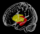 Brain areas affected by HIV, MRI scan