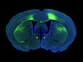 Mouse brain, fluorescent micrograph