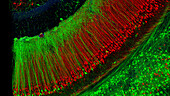 Mouse neuronal fibres, fluorescent micrograph