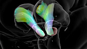 Substantia nigra in Parkinson's disease, DTI MRI scan