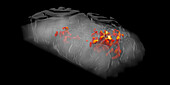 Resting brain, perfusion fMRI scan