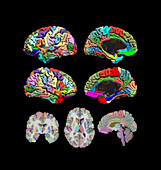 Mid-cortical surface brain areas, fMRI