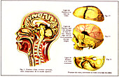 Neck and skull fractures, illustration