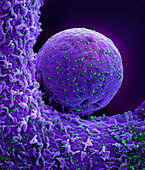 Cell infected by SARS-CoV-2 virus particles, SEM