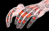 Hands and wrists, CT scan