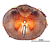 Human spinal cord, light micrograph