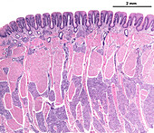 Tongue foliate papillae, light micrograph