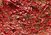 Red blood cells forming clot, SEM