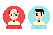 Hyperthyroidism treatment, conceptual illustration