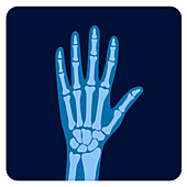 Hand bones, illustration
